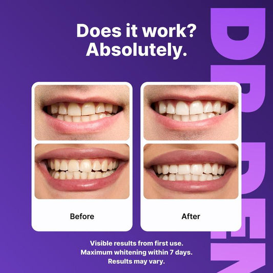 Radiant Smile | Teeth Whitening Strips with Color-Correction Technology | Enamel-Safe Formula for Sensitive Teeth 4