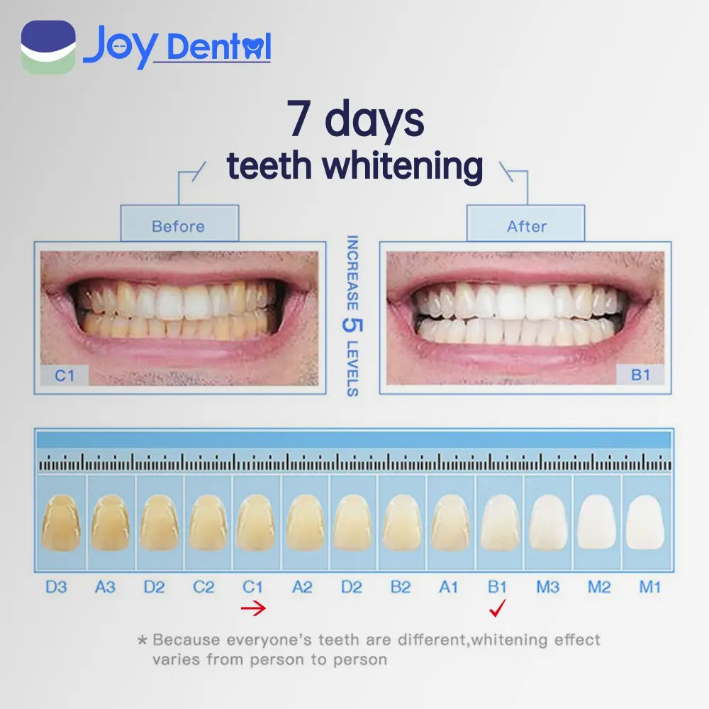 Instant Teeth Whitening Pen | Whitening Teeth Strips Visible Results in 7 Days Teeth Whitening Gel Opalescence Go Inopro Whitening Strips Feno Toothbrush Peroxide Free Teeth Whitening；Teeth Whitening Kits；Teeth Whiteners； Whitening Teeth Oral Sensitive