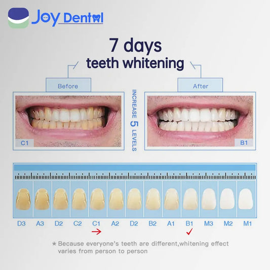 Instant Teeth Whitening Pen | Whitening Teeth Strips Visible Results in 7 Days Teeth Whitening Gel Opalescence Go Inopro Whitening Strips Feno Toothbrush Peroxide Free Teeth Whitening；Teeth Whitening Kits；Teeth Whiteners； Whitening Teeth Oral Sensitive