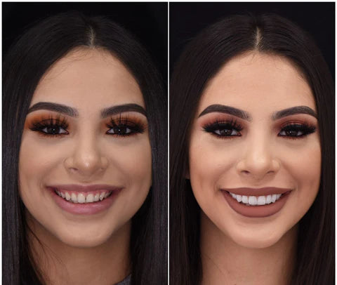 LumaGrin Quick Snap Veneers For Upper And Lower Teeth 5