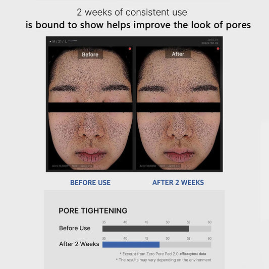 Pore Refining & Calming Pads