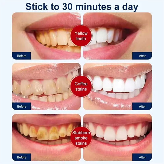 PurelyWHITE | Teeth Brightening Powder | Instant Brightening | For Sensitive Teeth