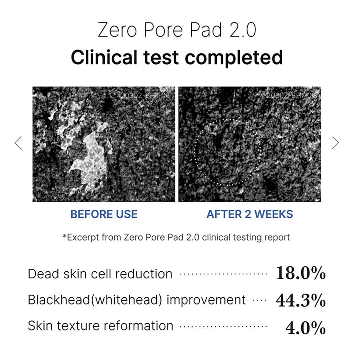 Pore Refining & Calming Pads