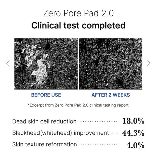 Pore Refining & Calming Pads