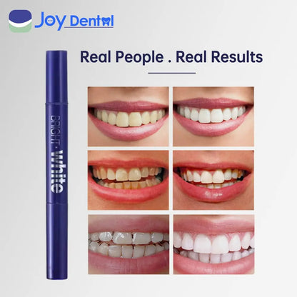 Instant Teeth Whitening Pen | Whitening Teeth Strips Visible Results in 7 Days Teeth Whitening Gel Opalescence Go Inopro Whitening Strips Feno Toothbrush Peroxide Free Teeth Whitening；Teeth Whitening Kits；Teeth Whiteners； Whitening Teeth Oral Sensitive